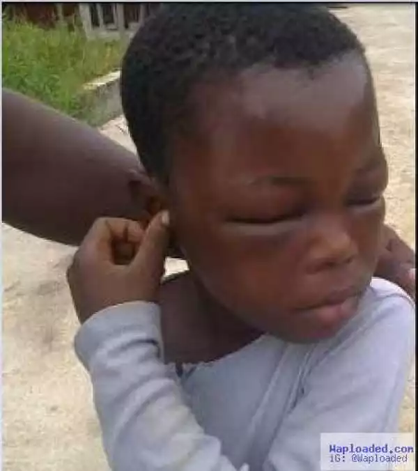 Unbelievable! See What Wicked Woman Did to This Little House-maid in Bayelsa (Photos)